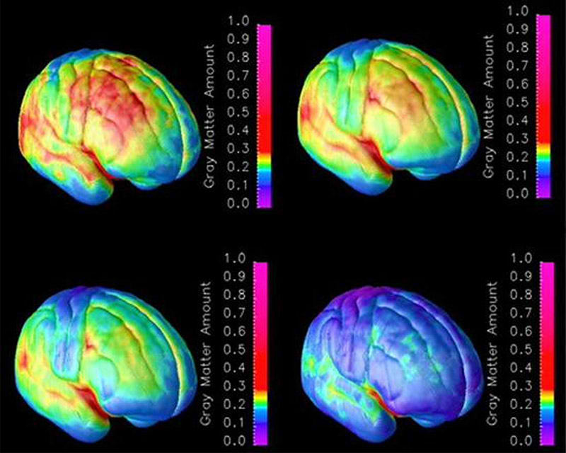 Proceso mental en im�genes mientras se obtiene recuerdos de la memoria del cerebro