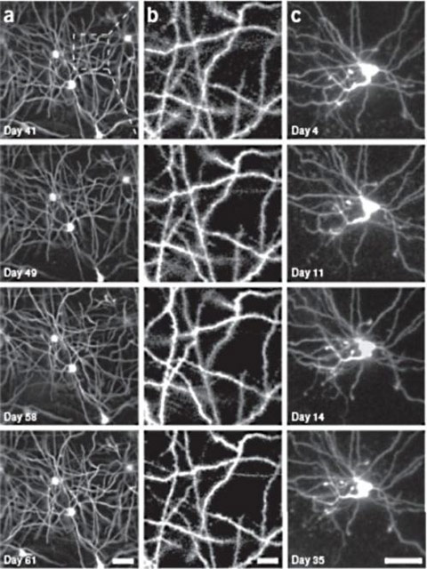 Im�genes de neuronas del hipocampo de rat�n en d�as y escalas diferentes. La columna b es la ampliaci�n de una zona de la columna a. La columna d son im�genes de dendritas