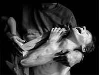 Ni�o deforme por causa de la radiaci�n desatada en el desastre de Chernobyl