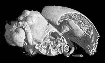 Disecci�n computarizada en 3D utilizando escaneo de rayos X
