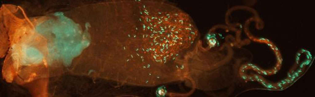 Aparato reproductor (menos los ovarios) de una mosca de la fruta hembra que ha copulado con dos machos. Los espermatozoides verdes, que pertenecen a uno de los machos, han abandonado los �rganos de almacenamiento y se mezclan con el esperma rojo de su competidor en la cabeza de la bolsa. Foto: S. Pitnick