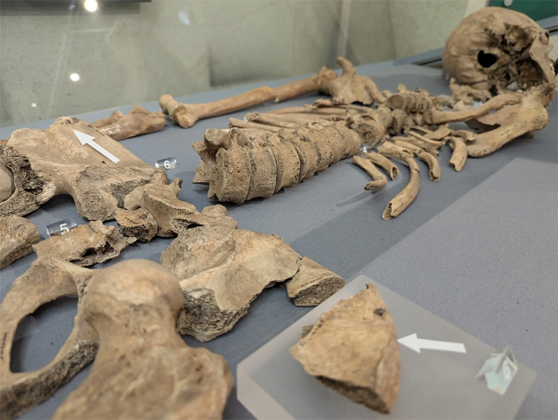 Restos de gladiador romano en York, exhibiendo mordidas. Foto: York Archaeology