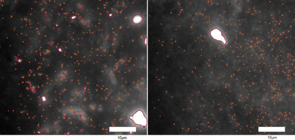 Visualizaciones del los oligómeros de alfa-sinucleína en tejido cerebral. Imágenes:  Universidad de Cambridge